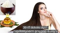മുപ്പത് കഴിഞ്ഞുള്ള മുടി കൊഴിച്ചില്‍ പെട്ടെന്ന് പരിഹരിക്കാം: ആവണക്കെണ്ണ മിക്‌സ്