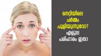 നെറ്റിയിലെ ചുളിവുകള്‍ക്ക് പരിഹാരം ഈ വീട്ടുവൈദ്യങ്ങള്‍