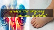 കാലില്‍ നീര് ഇങ്ങനെയെങ്കില്‍ കിഡ്‌നിക്ക് ഗുരുതര തകരാറ്: വേദനയും ചൊറിച്ചിലും പുറകേ