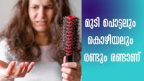 മുടി കൊഴിച്ചിൽ, മുടി പൊട്ടൽ, ഇനി ആശങ്ക വേണ്ട,പരിഹാരം ഇതാ