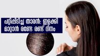 താരന്‍ തലയോട്ടിയില്‍ പറ്റിയിരിക്കുന്നോ: പെട്ടെന്ന് കളയാന്‍ രണ്ട് ദിവസം മിനക്കെടാം