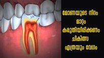 നിങ്ങളുടെ മോണയുടെ നിറം പിങ്കോ ചുവപ്പോ, കരുതിയിരിക്കേണ്ട രോഗങ്ങള്‍