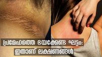 ശരീരത്തില്‍ പ്രമേഹം വര്‍ദ്ധിപ്പിക്കുന്നെന്ന് കാണിക്കുന്ന അസാധാരണ ലക്ഷണങ്ങള്‍