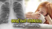 ചൈനയിലേതിന് സമാനം, എന്താണ് വൈറ്റ് ലംഗ് സിന്‍ഡ്രോം? അത്യന്തം അപകട സാധ്യത