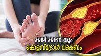 രാത്രിയില്‍ കാലില്‍ വേദനയും തരിപ്പുമുണ്ടോ? കൊളസ്‌ട്രോളിന്റെ അപകട ലക്ഷണം