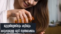 മുടിയില്ലെന്ന് പറഞ്ഞിനി സങ്കടപ്പെടേണ്ട: മുടിവളര്‍ച്ചക്ക് ഉറപ്പ് നല്‍കും മാര്‍ഗ്ഗം