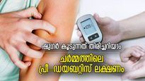 ഷുഗര്‍ കൂടിയാല്‍ ചര്‍മ്മത്തില്‍ കാണും മാറ്റം; പ്രീ-ഡയബറ്റിസിന്റെ 5 ലക്ഷണങ്ങള്‍