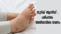 യൂറിക് ആസിഡിനെ എളുപ്പത്തില്‍ ഒതുക്കുന്ന 5 മാര്‍ഗ്ഗങ്ങള്‍