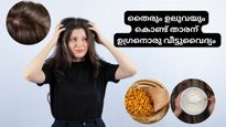 താരന്‍ ആണോ പ്രശ്‌നം? തൈരും ഉലവയും കൊണ്ട് ഇങ്ങനെയൊരു മരുന്ന് പരീക്ഷിക്കൂ