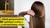 മുടിയുടെ പ്രശ്‌നങ്ങളോര്‍ത്ത് സങ്കടപ്പെടേണ്ട; ഇതിലും മികച്ച മറ്റൊരു പരിഹാരമില്ല