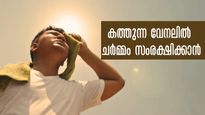കത്തുന്ന ചൂടില്‍ വിയര്‍ത്തൊലിച്ച് ചൊറിച്ചില്‍ വില്ലനാവുന്നോ, പരിഹാരത്തിന് 5 മിനിറ്റ്