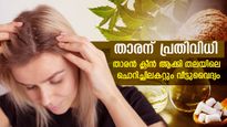 ഇളകി വരുന്ന താരനെ പൂര്‍ണമായും ഇളക്കി മാറ്റുന്ന സൂപ്പര്‍ ഹെയര്‍പാക്ക്