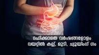 കല്ല്, മുടി, ച്യൂയിഗ് ഗം: വര്‍ഷങ്ങളോളം ദഹിക്കാതെ വയറ്റില്‍ കിടക്കുമോ, ഇത്തരമിതാ