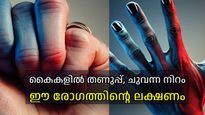 കൈകകളില്‍ കാണുന്ന ഈ മാറ്റങ്ങള്‍ അവഗണിക്കല്ലേ, അത് ചില രോഗങ്ങളുടെ ലക്ഷണമാകാം