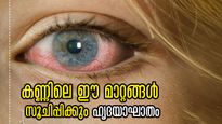 ഹൃദയാഘാതം ഒരുമാസം മുന്നേ പറയും കണ്ണിലെ മാറ്റങ്ങള്‍