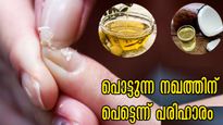 പൊട്ടുന്ന പൊളിയുന്ന നഖങ്ങള്‍ ചില സൂചനയാണ്: 2 തുള്ളി നാരങ്ങ നീരില്‍ പരിഹാരം