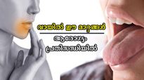 പ്രമേഹവും ക്യാന്‍സറും ഉള്‍പ്പടെ ഈ രോഗങ്ങള്‍ വായ നോക്കി മനസ്സിലാക്കാം