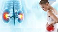 സ്ത്രീകളില്‍ അവഗണിക്കാന്‍ പാടില്ലാത്ത കിഡ്‌നി രോഗ ലക്ഷണങ്ങള്‍ ഇവയാണ്