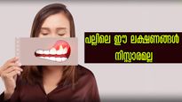 വായിലെ ഈ ലക്ഷണങ്ങള്‍ നിസ്സാരമല്ല : അപകടം പല്ലില്‍ ഒളിച്ചിരിക്കുന്നു, അറിയേണ്ടത്