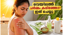 കഠിനമായ വേനൽച്ചൂടിൽ ചർമ്മം കരിഞ്ഞുപോകുമോ? വെയിലിൽ നിന്ന് രക്ഷനേടാൻ ഈ പൊടിക്കൈകൾ പരീക്ഷിക്കൂ