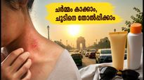 ഡൽഹിയിൽ കടുത്ത ചൂടും വിയർപ്പും; ചർമ്മപ്രശ്നങ്ങളില്ലാതെ ഈ ദിവസങ്ങളെ അതിജീവിക്കാൻ ഇതാ ചില വഴികൾ