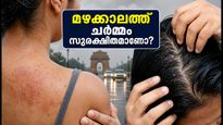 ഡൽഹിയിലെ മഴക്കാലം; ചർമ്മവും മുടിയും ഫംഗസ് ബാധയിൽ നിന്ന് രക്ഷിക്കാൻ ഈ മുൻകരുതലുകൾ മതി