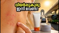 ഡൽഹിയിലെ കടുത്ത ചൂട്; വിയർപ്പുകുരുവും ചൊറിച്ചിലും ഒഴിവാക്കാൻ ഈ മുൻകരുതലുകൾ മതി!