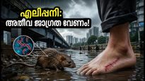 മുംബൈയിൽ എലിപ്പനി ഭീഷണി; മഴവെള്ളത്തിലൂടെ നടക്കുമ്പോൾ ഈ കാര്യങ്ങൾ ശ്രദ്ധിച്ചില്ലെങ്കിൽ അപകടം!