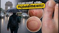 മഴക്കാലത്തെ ഫംഗസ് ബാധ പേടിപ്പെടുത്തുന്നുണ്ടോ? ചർമ്മത്തെ സംരക്ഷിക്കാൻ ഈ ലളിതമായ വഴികൾ പരീക്ഷിക്കൂ