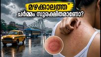 മഴക്കാലത്ത് ചർമ്മം ചൊറിഞ്ഞു തടിക്കുന്നുണ്ടോ? ഈ ലളിതമായ കാര്യങ്ങൾ ശ്രദ്ധിച്ചാൽ മതി!