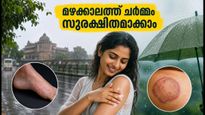 മഴക്കാലത്ത് ചർമ്മം ചൊറിയുന്നുണ്ടോ? യുപി-ബിഹാറിലെ യാത്രക്കാർ അണുബാധ തടയാൻ ഈ മുൻകരുതലുകൾ എടുക്കൂ