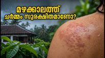 മഴക്കാലത്ത് ചർമ്മവും തലയോട്ടിയും സുരക്ഷിതമാണോ? അണുബാധകളെ തടയാൻ ഈ മുൻകരുതലുകൾ എടുക്കൂ