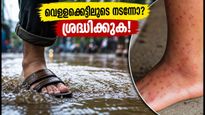 മുംബൈയിൽ എലിപ്പനി ജാഗ്രത: വെള്ളക്കെട്ടിലൂടെ നടന്നവരാണോ നിങ്ങൾ? 72 മണിക്കൂറിനുള്ളിൽ ഈ മുൻകരുതലുകൾ എടുക്കൂ