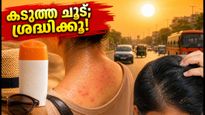 കടുത്ത ചൂടും ഈർപ്പവും; ചർമ്മവും തലയോട്ടിയും സുരക്ഷിതമാക്കാൻ ഈ മുൻകരുതലുകൾ മറക്കരുത്