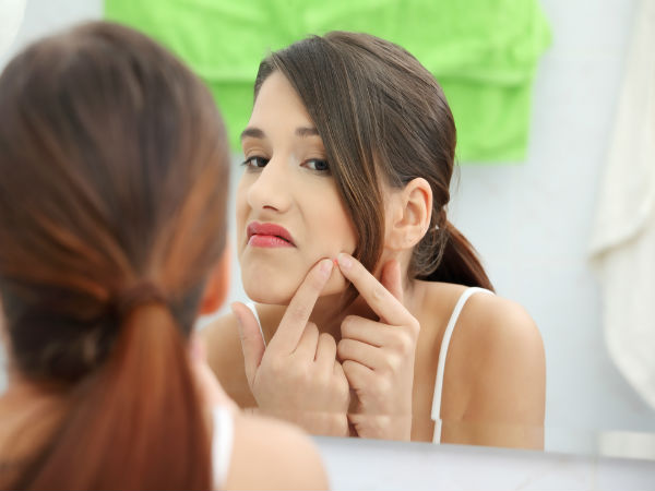 മുഖക്കുരു, വിശ്വാസങ്ങളും വാസ്തവങ്ങളും