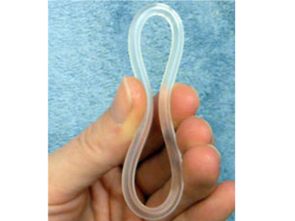 ഗര്‍ഭനിരോധനത്തിന് വിവിധ വഴികള്‍