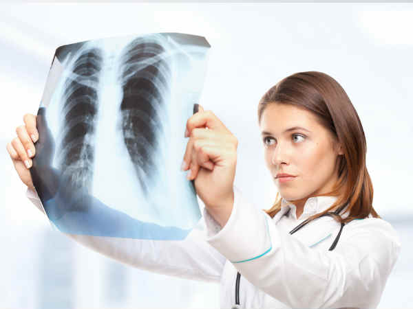 എക്‌സ്‌റേ 