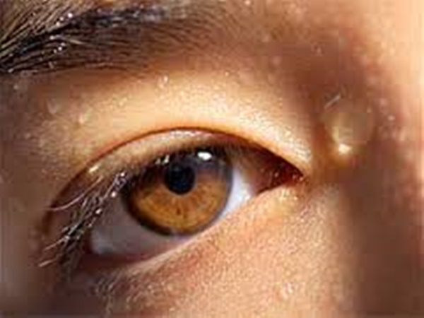 കണ്‍കുരു