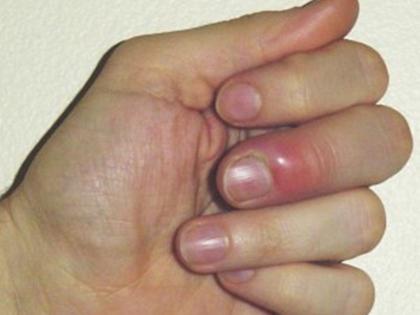 ചുവപ്പ് നിറം