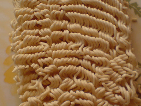 നാഡീ തകരാര്‍