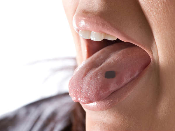 പാടുകള്‍