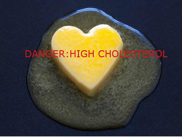 കൊളസ്‌ട്രോള്‍