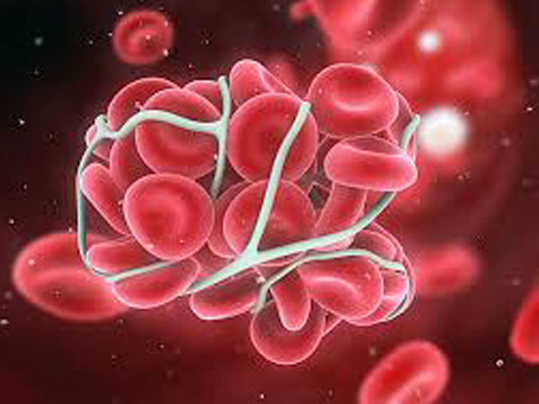 ഹാര്‍ട്ട് അറ്റാക്ക്