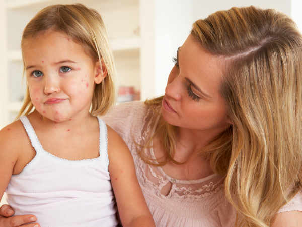 ചിക്കനുമായി യാതൊരു ബന്ധവുമില്ല