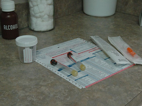 മൂത്രപരിശോധന 