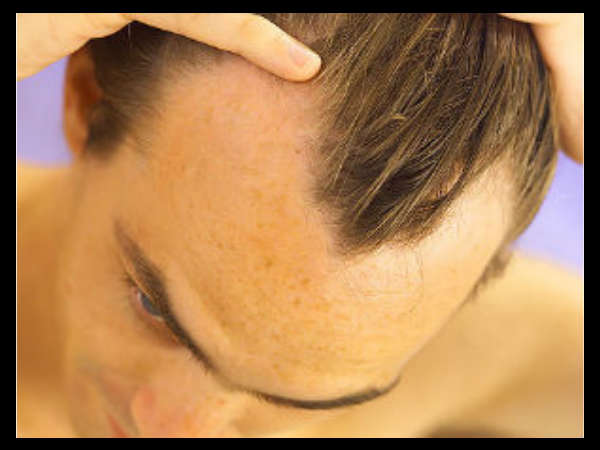 തലയോട്ടിയിലെ ഇന്‍ഫക്ഷന്‍