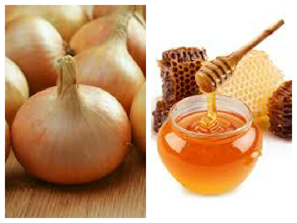 തേനും ഉള്ളി നീരും