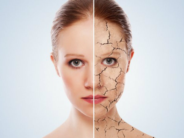 വരണ്ട ചര്‍മ്മത്തെ പ്രതിരോധിയ്ക്കുന്നു