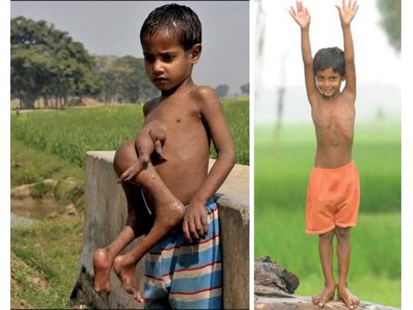 കൈകാലിന്റെ എണ്ണം കൂടുതല് കൈകാലിന്റെ എണ്ണം കൂടുതല്