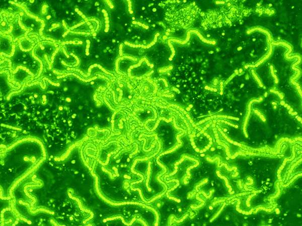 ഇ-കോളി, സാല്മൊണല്ല... ഇ-കോളി, സാല്മൊണല്ല...